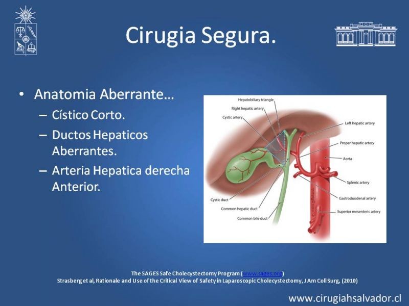 Diapositiva 17 de Colecsitectomía Segura