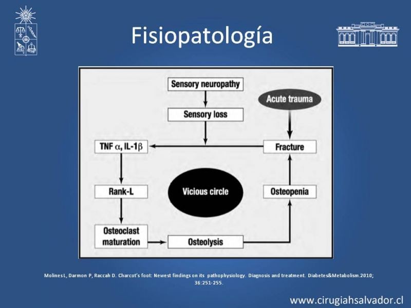 Diapositiva 5 de Artropatía de Charcot