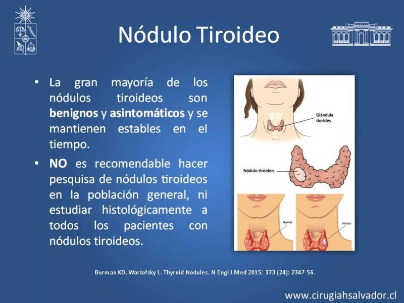 Diapositiva 4 de Nódulo Tiroideo