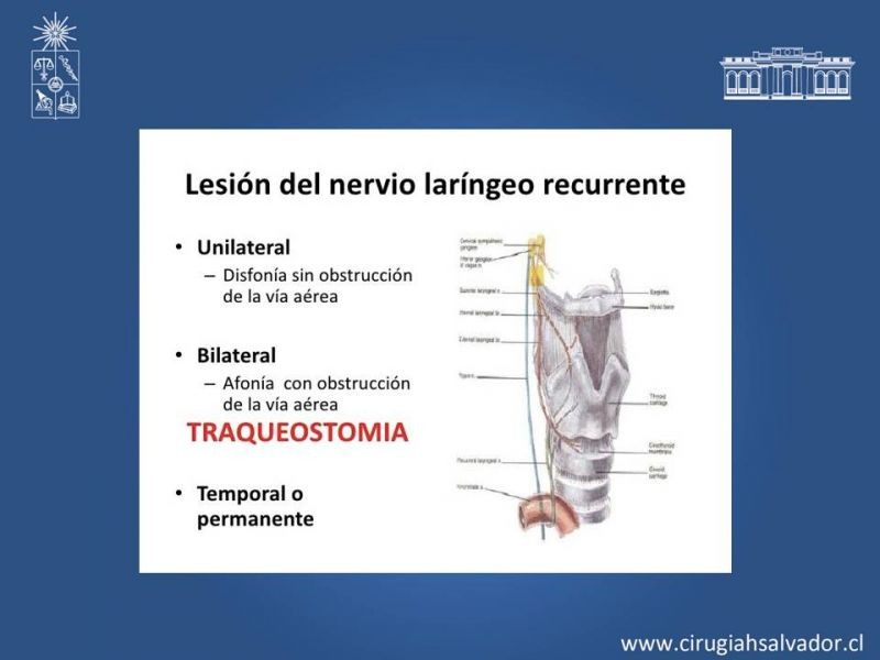 Diapositiva 11 de Nódulo Tiroideo