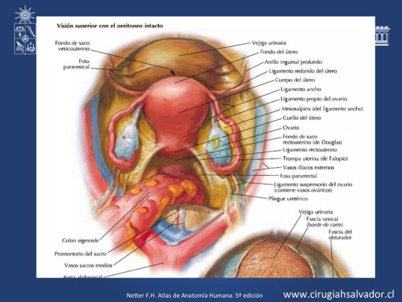 Diapositiva 5 de Lesiones iatrogénicas del sistema urinario en la cirugía colorrectal