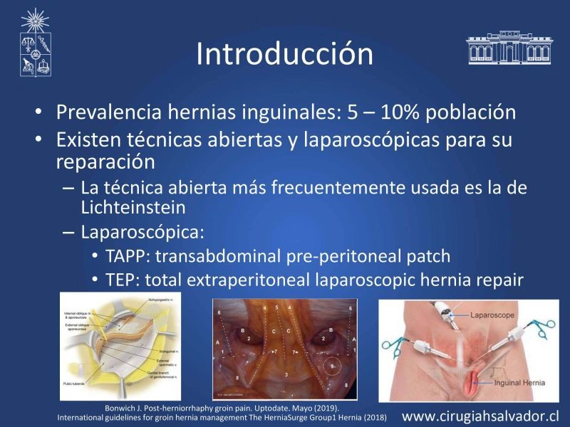 Diapositiva 2 de Inguinodinia post hernioplastía inguinal