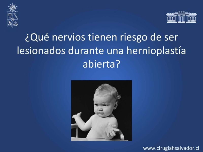 Diapositiva 4 de Inguinodinia post hernioplastía inguinal