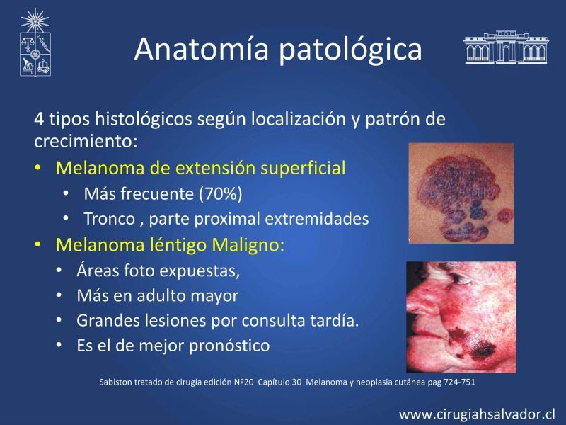 Diapositiva 12 de Melanoma: enfrentamiento inicial