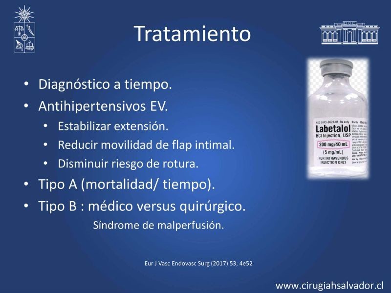 Diapositiva 13 de Síndrome Aórtico Agudo 
