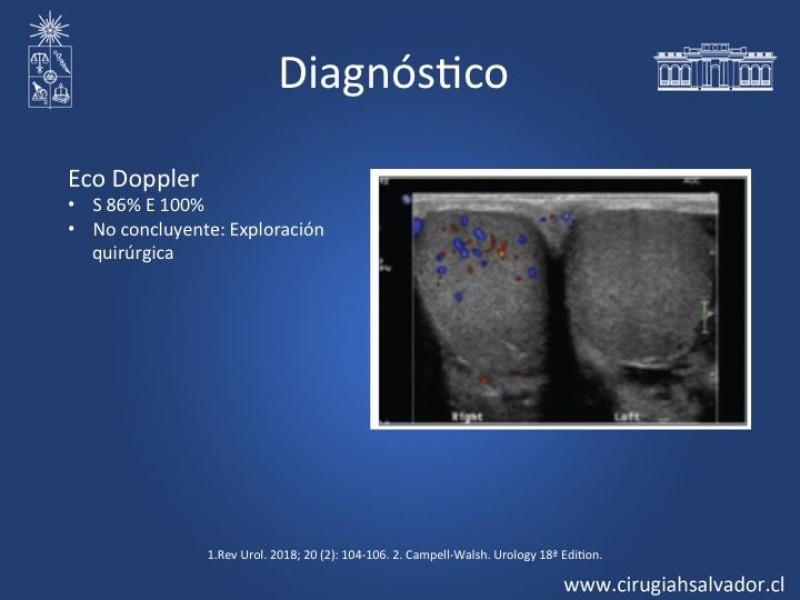 Diapositiva 9 de Tratamiento y pronóstico torsión testicular 