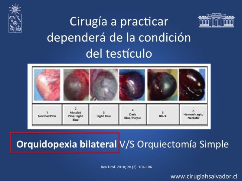 Diapositiva 10 de Tratamiento y pronóstico torsión testicular 