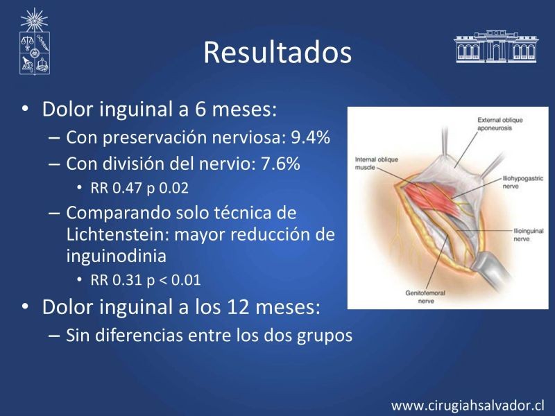 Diapositiva 12 de Inguinodinia post hernioplastía inguinal
