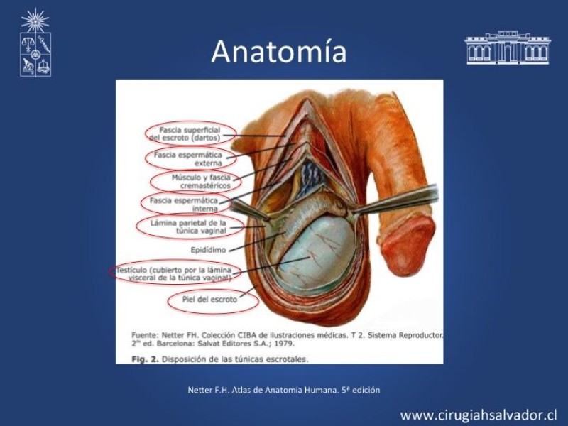 Diapositiva 4 de Tratamiento y pronóstico torsión testicular 