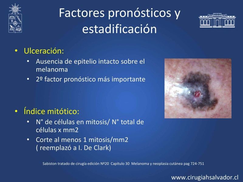 Diapositiva 17 de Melanoma: enfrentamiento inicial