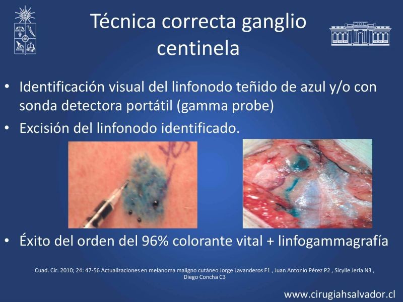 Diapositiva 21 de Melanoma: enfrentamiento inicial