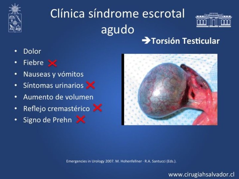 Diapositiva 7 de Tratamiento y pronóstico torsión testicular 