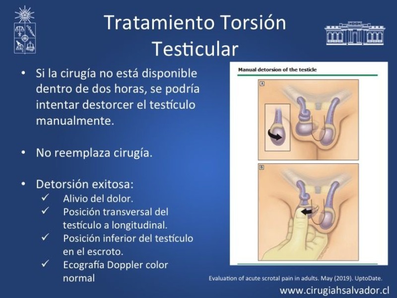 Diapositiva 15 de Tratamiento y pronóstico torsión testicular 