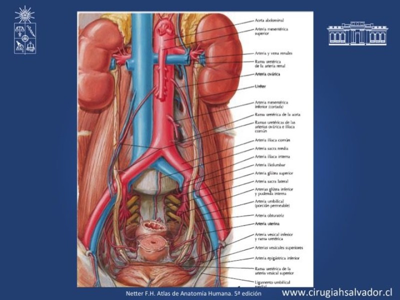 Diapositiva 3 de Lesiones iatrogénicas del sistema urinario en la cirugía colorrectal