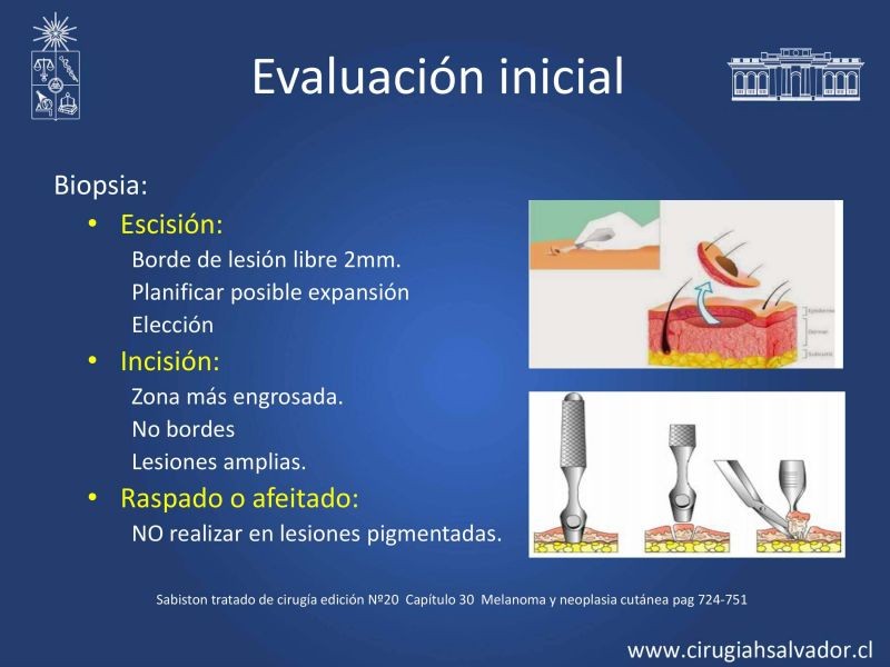 Diapositiva 11 de Melanoma: enfrentamiento inicial