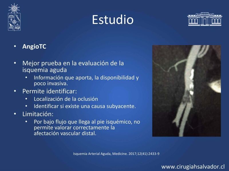 Diapositiva 12 de Isquemia aguda de extremidades inferiores