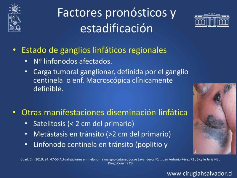 Diapositiva 18 de Melanoma: enfrentamiento inicial