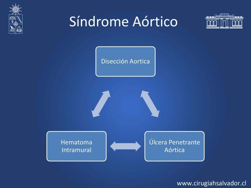 Diapositiva 2 de Síndrome Aórtico Agudo 