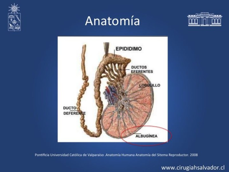 Diapositiva 5 de Tratamiento y pronóstico torsión testicular 