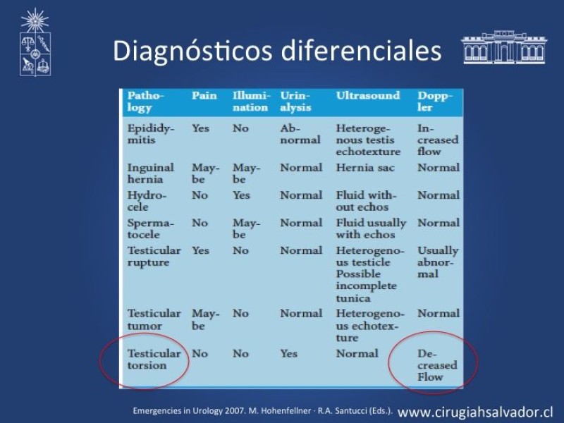 Diapositiva 8 de Tratamiento y pronóstico torsión testicular 