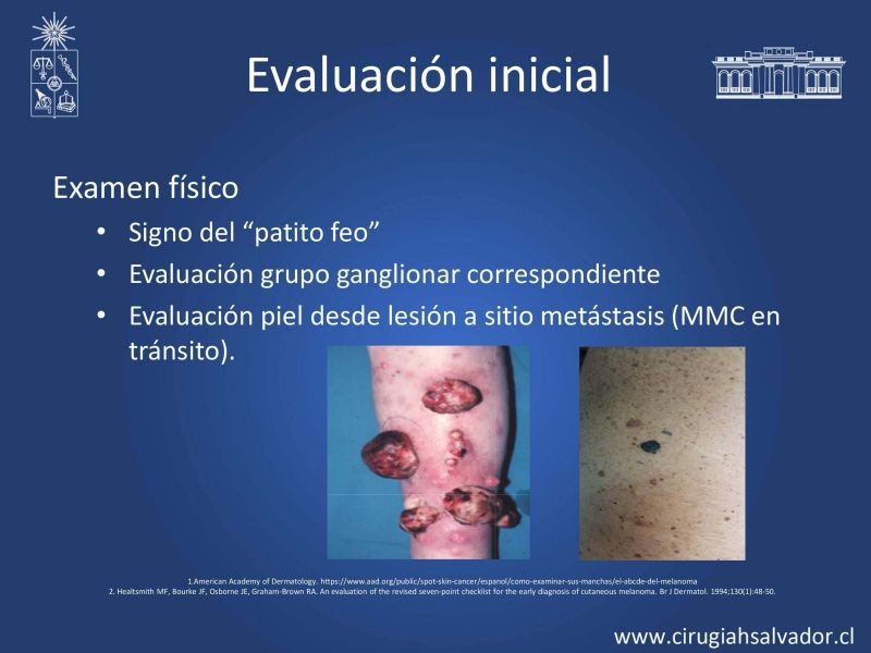Diapositiva 10 de Melanoma: enfrentamiento inicial