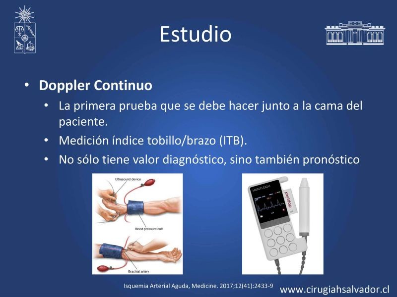 Diapositiva 10 de Isquemia aguda de extremidades inferiores