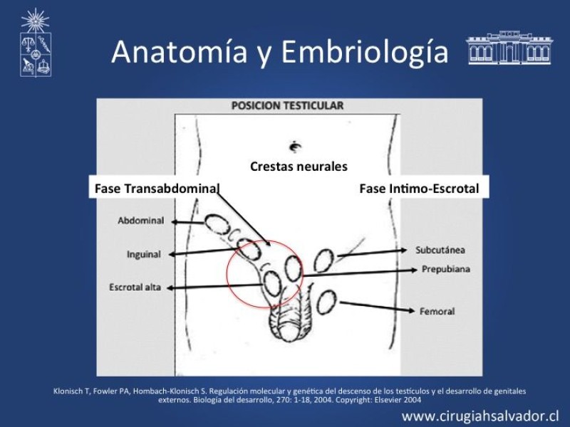 Diapositiva 3 de Tratamiento y pronóstico torsión testicular 