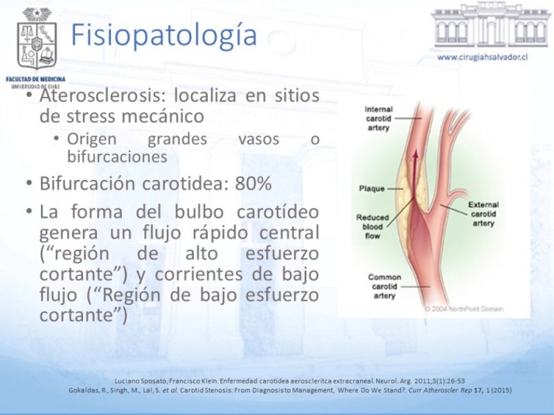 Diapositiva 7 de Enfermedad carotídea sintomática