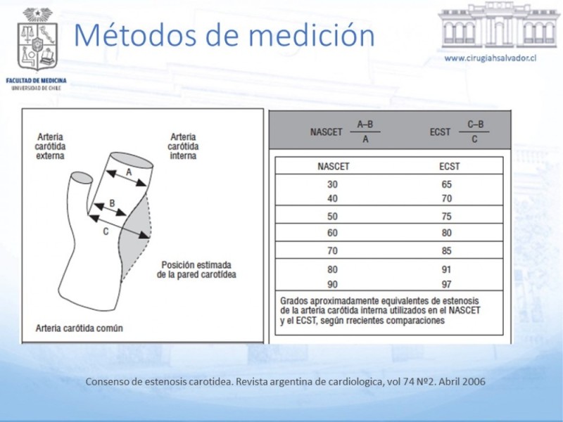 Diapositiva 11 de Enfermedad carotídea sintomática