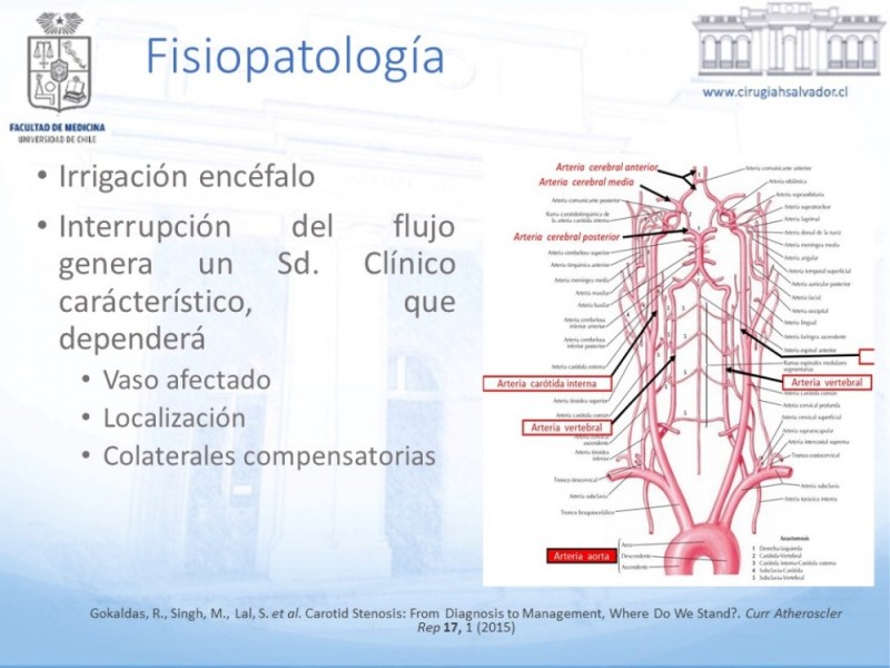 Diapositiva 6 de Enfermedad carotídea sintomática
