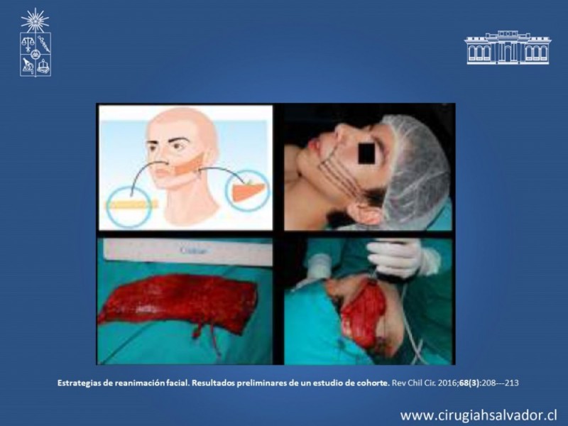 Diapositiva 26 de Reanimación Facial