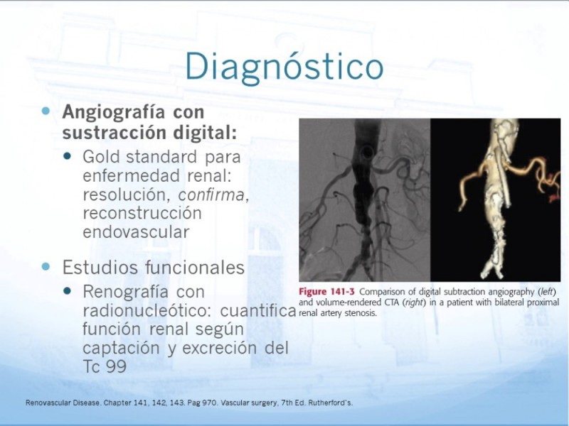 Diapositiva 10 de Enfermedad Renovascular
