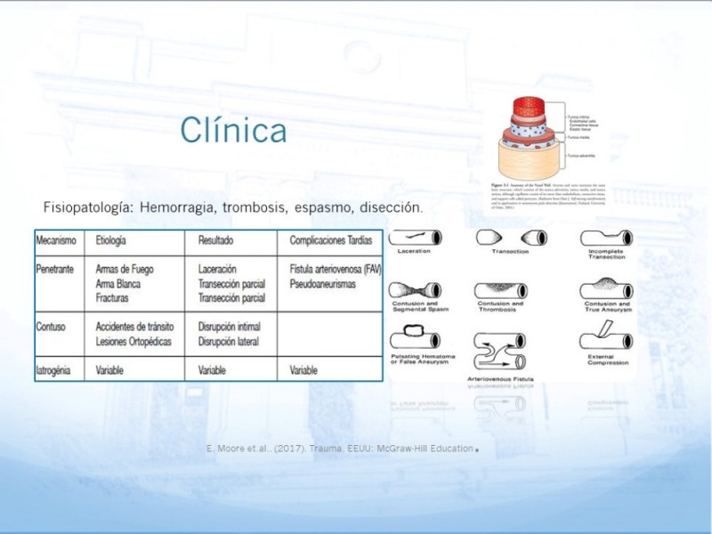 Diapositiva 5 de Control de lesión vascular para el cirujano general