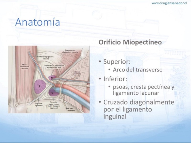 Diapositiva 15 de Hernia Inguinal: Hitos Anatómicos para cirugía laparoscópica-3