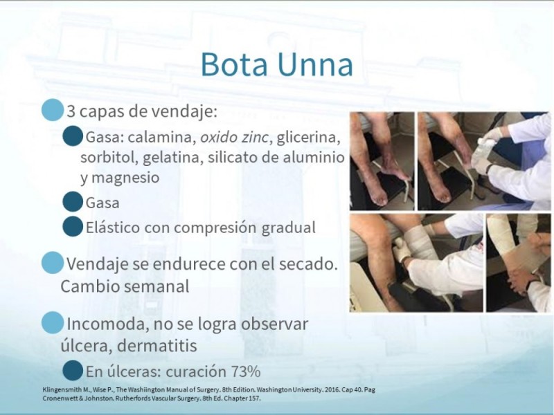 Diapositiva 16 de Insuficiencia Venosa Crónica