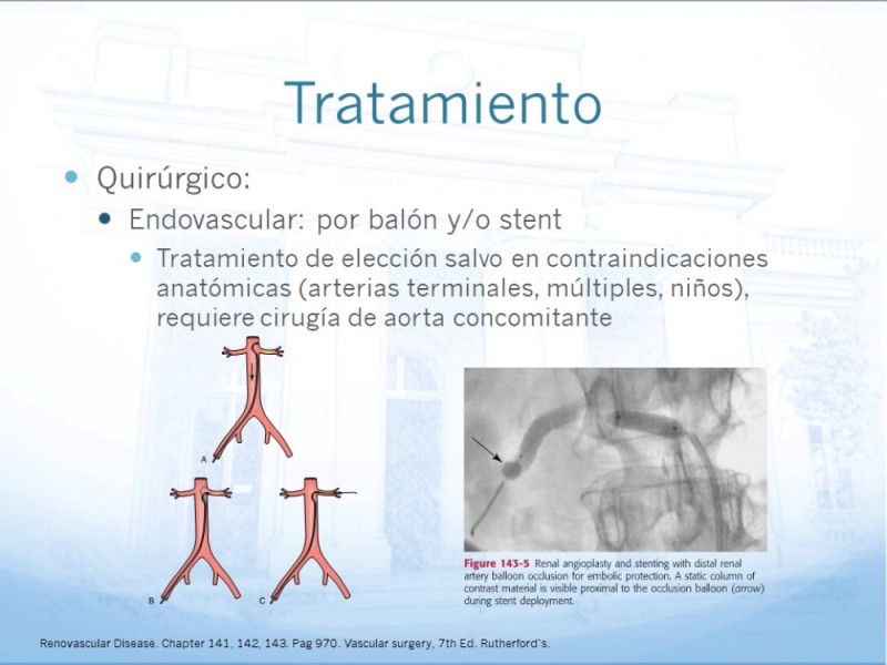 Diapositiva 13 de Enfermedad Renovascular