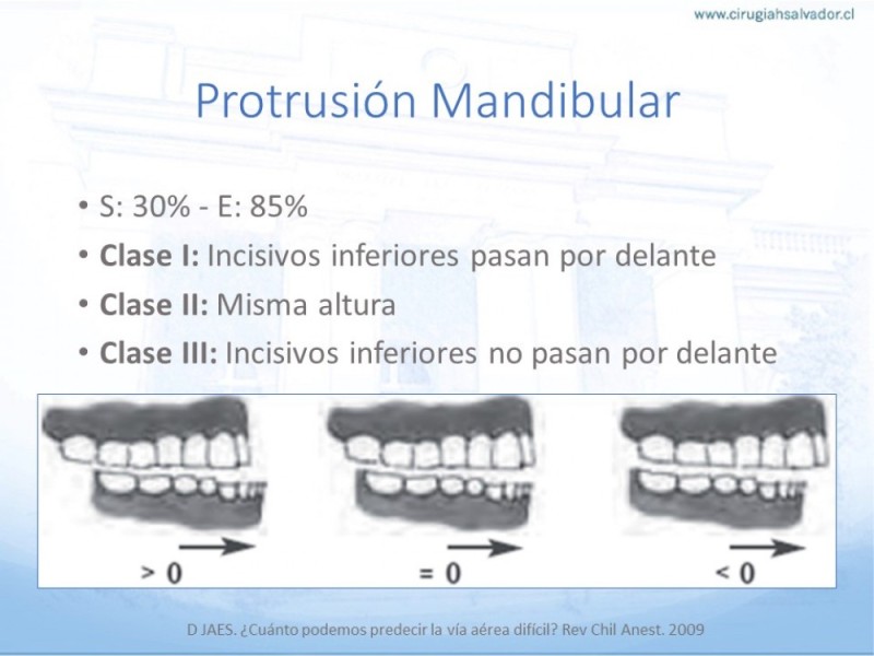 Diapositiva 13 de Manejo de Vía Aérea. Evaluación, Dispositivos y Algoritmos DAS