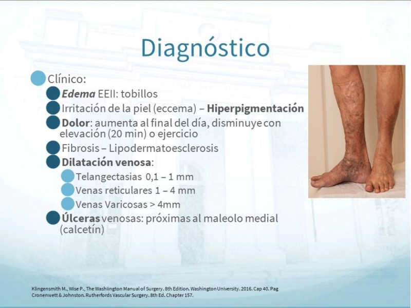 Diapositiva 5 de Insuficiencia Venosa Crónica