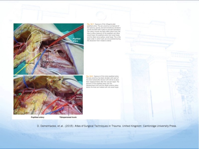 Diapositiva 26 de Control de lesión vascular para el cirujano general