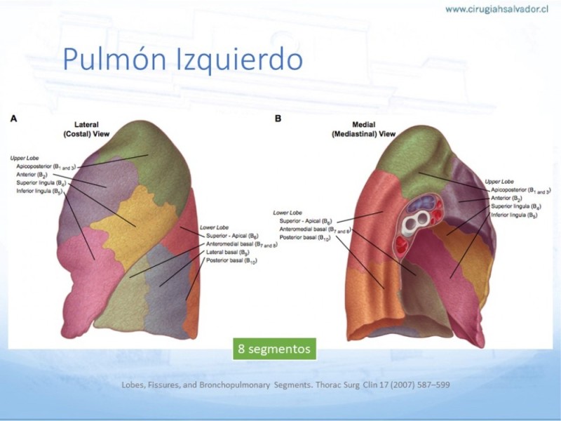 Diapositiva 4 de Anatomía Quirúrgica: Pulmón y Bronquios