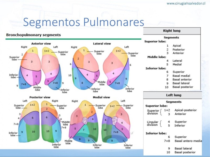 Diapositiva 6 de Anatomía Quirúrgica: Pulmón y Bronquios