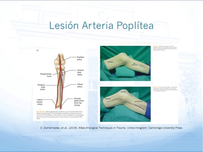 Diapositiva 24 de Control de lesión vascular para el cirujano general