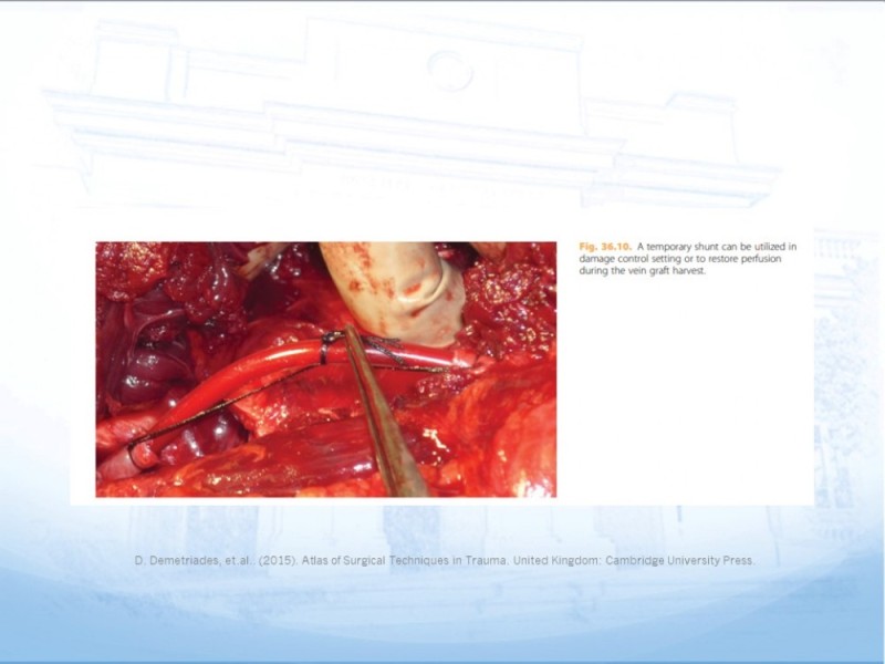 Diapositiva 27 de Control de lesión vascular para el cirujano general