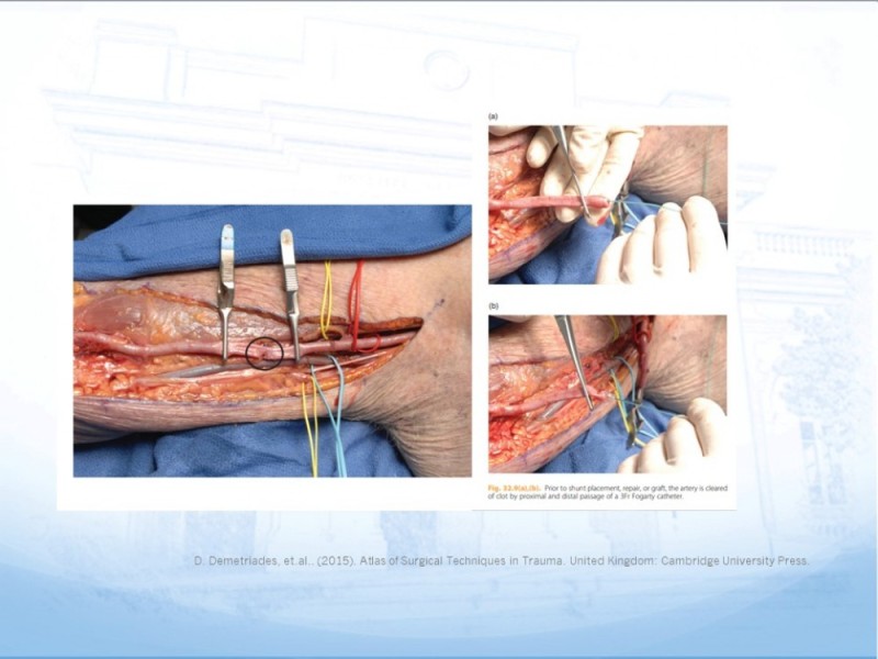 Diapositiva 19 de Control de lesión vascular para el cirujano general