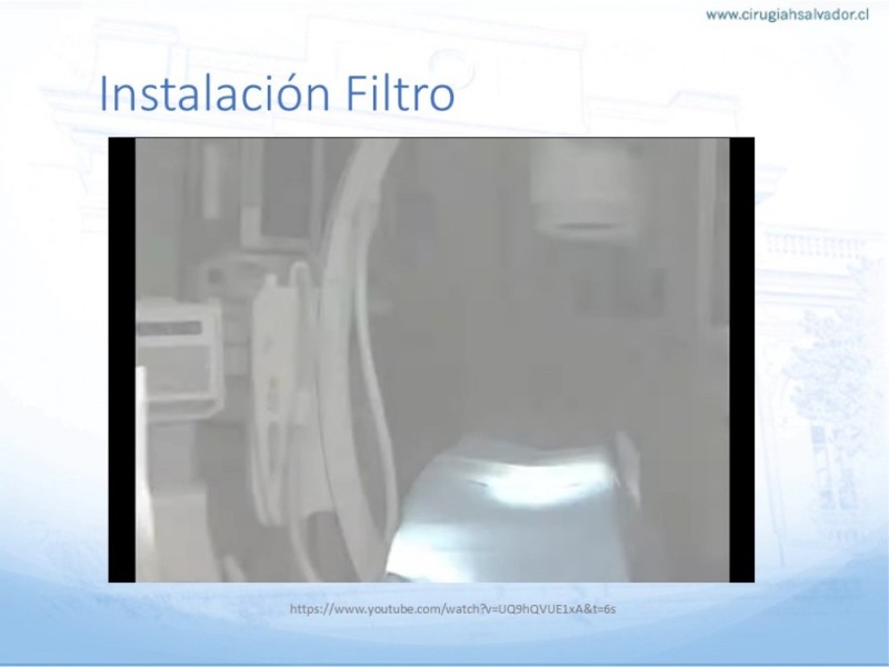 Diapositiva 19 de Indicaciones de Filtro de Vena Cava