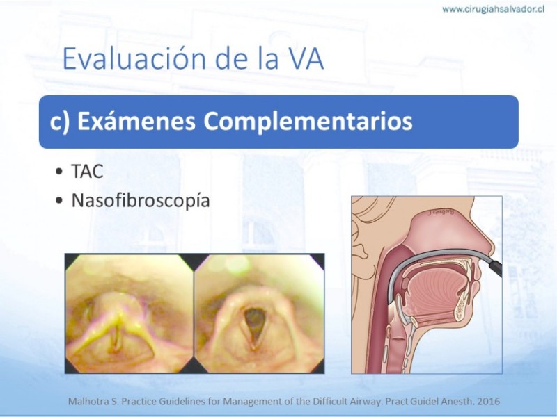 Diapositiva 15 de Manejo de Vía Aérea. Evaluación, Dispositivos y Algoritmos DAS