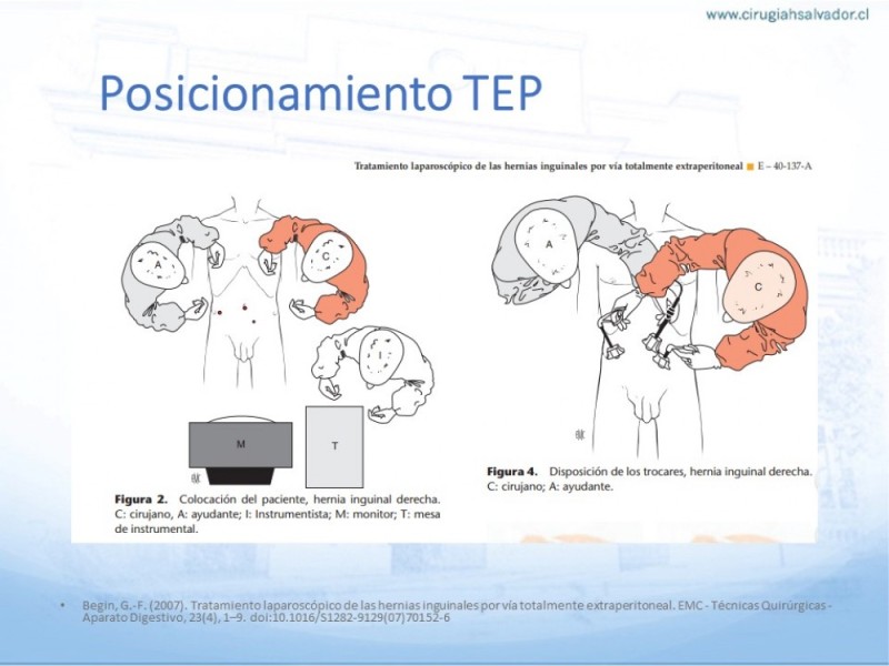 Diapositiva 26 de Hernia Inguinal: Hitos Anatómicos para cirugía laparoscópica-3