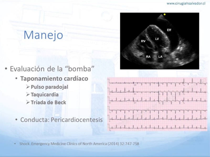 Diapositiva 15 de Generalidades  del Shock