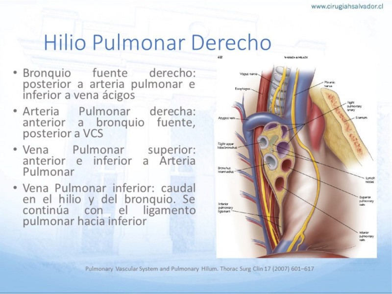 Diapositiva 7 de Anatomía Quirúrgica: Pulmón y Bronquios