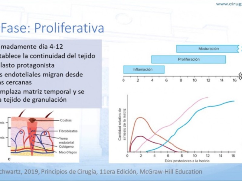 Diapositiva 7 de Cicatrización normal y patológica